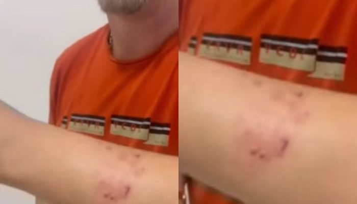 Policial mordido em Teresina (Foto: Reprodução)